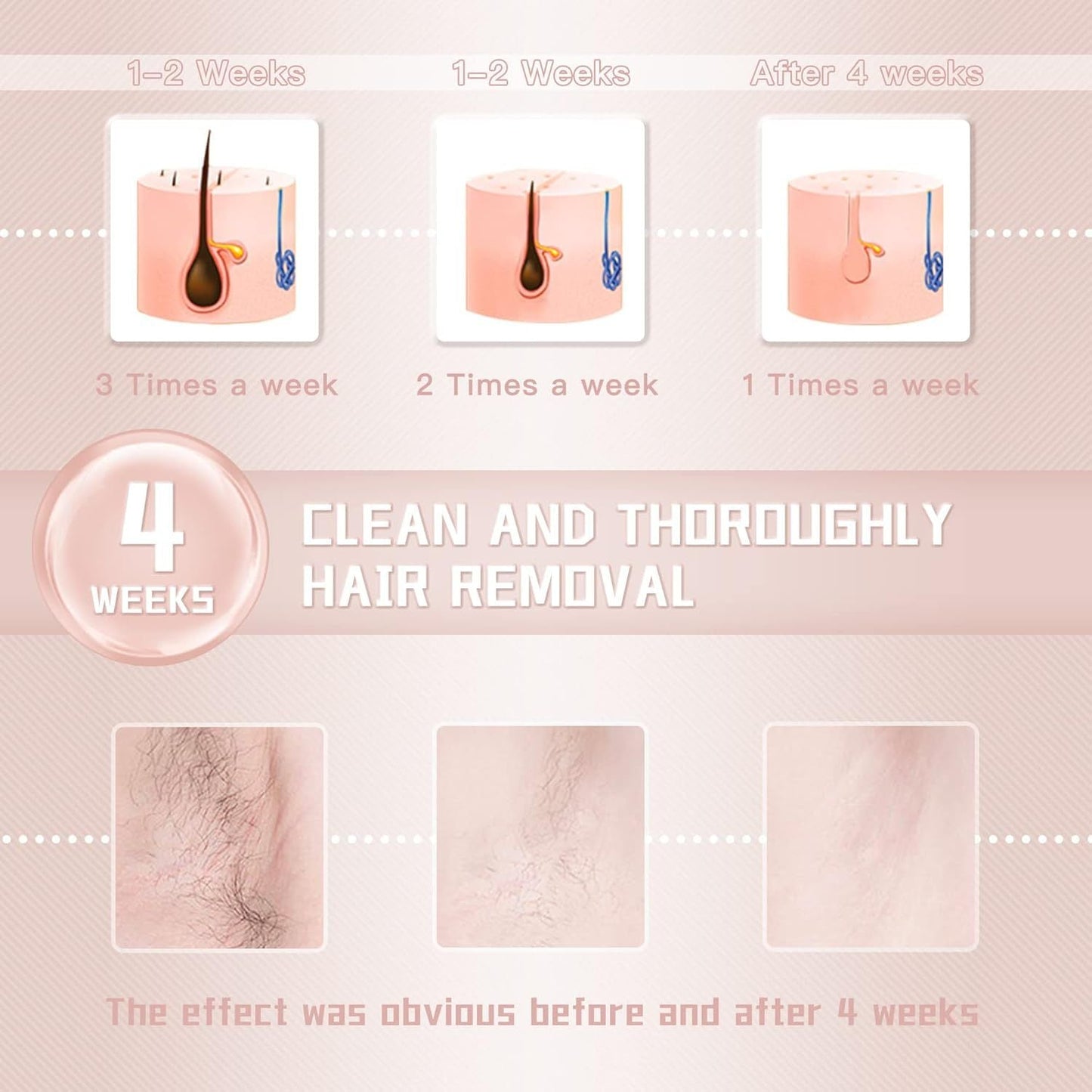 IPL Laser Hair Removal Device for Women