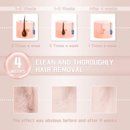 IPL Laser Hair Removal Device for Women